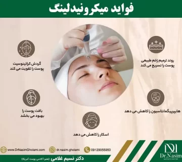 مزایای میکرونیدلینگ