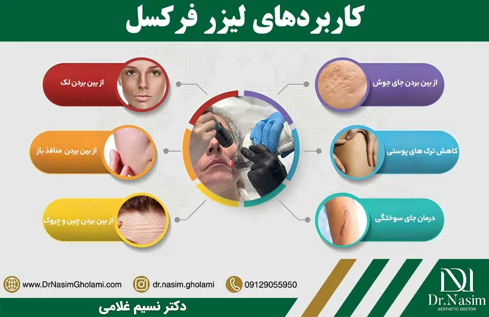 کاربردهای لیزر فرکسل چیست