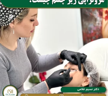 مزوتراپی زیر چشم چیست