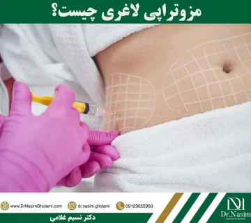 مزوتراپی لاغری چیست