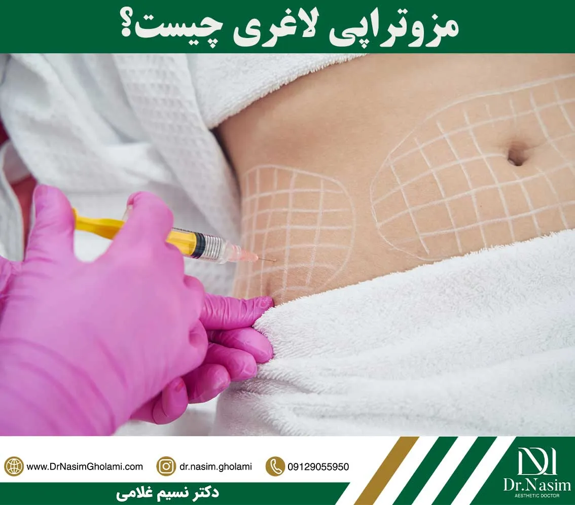 مزوتراپی لاغری چیست