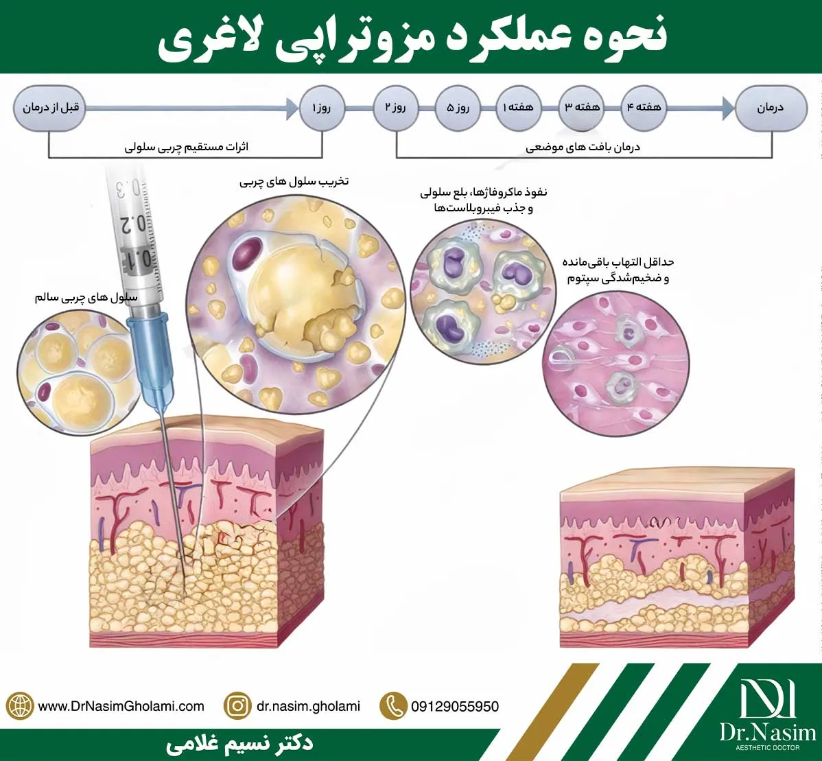نحوه عملکرد و تاثیر مزو لاغری