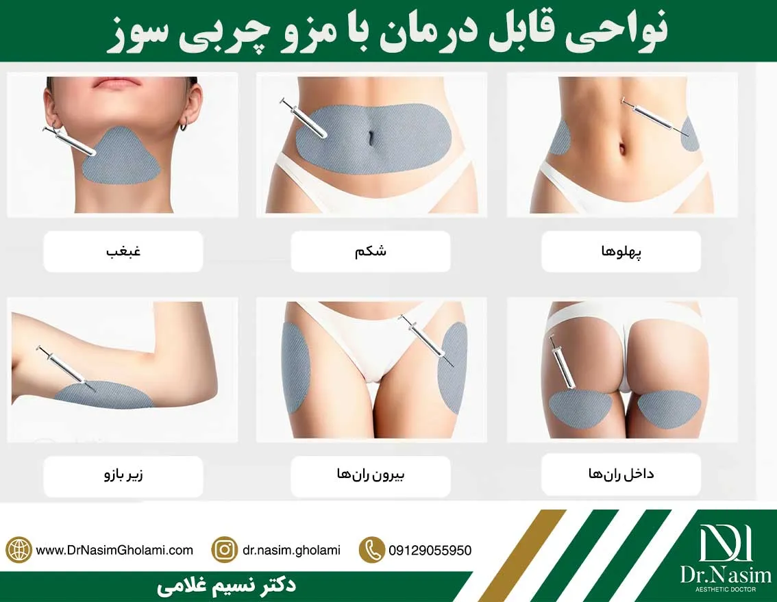 مزوتراپی لاغری در نقاط مختلف بدن