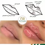 ژل لب مدل عروسکی