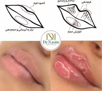 ژل لب مدل عروسکی