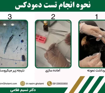 نحوه انجام تست دمودکس