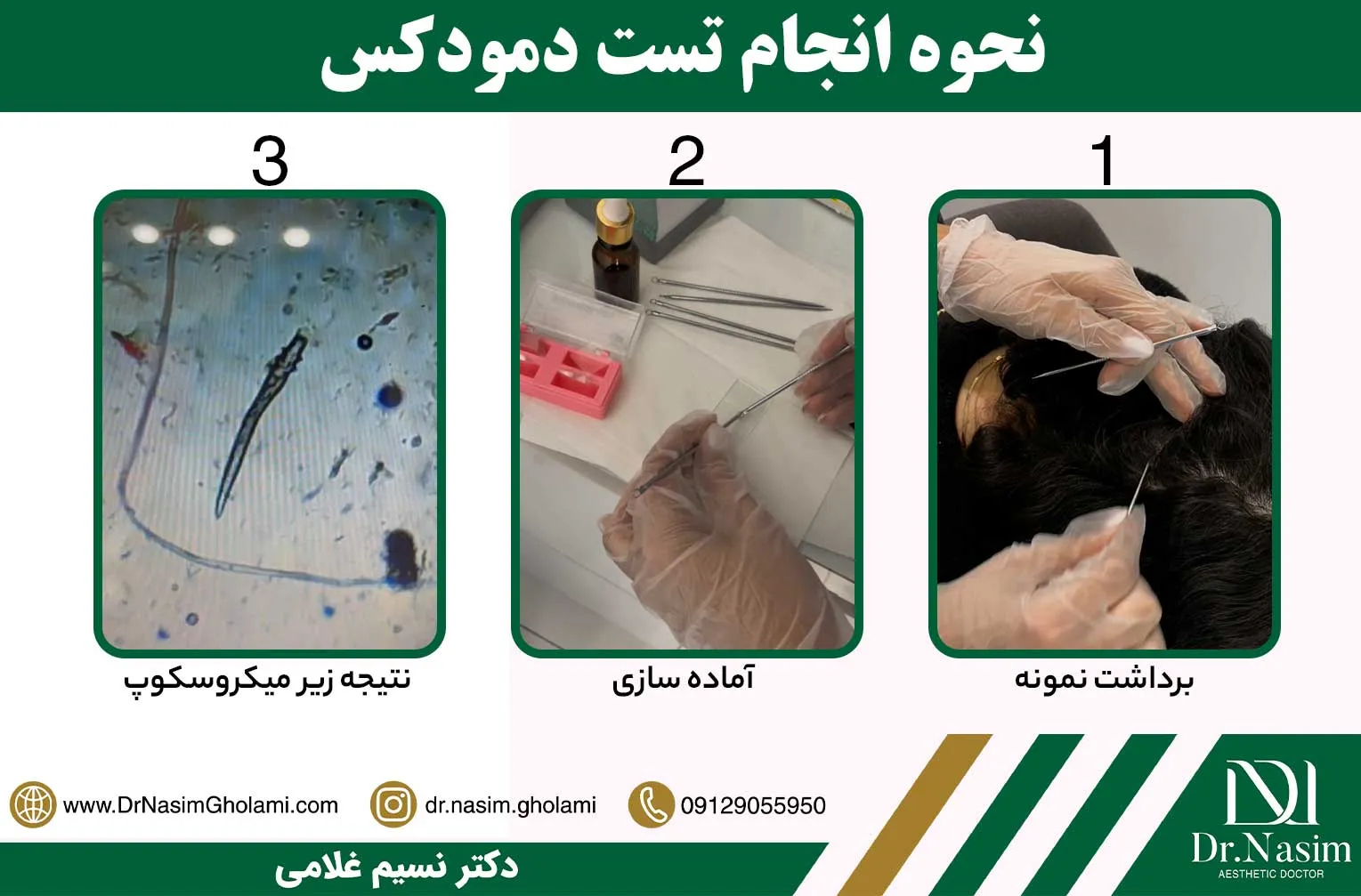 نحوه انجام تست دمودکس