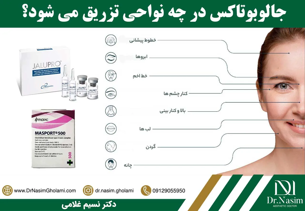 نواحی تزریق جالوبوتاکس