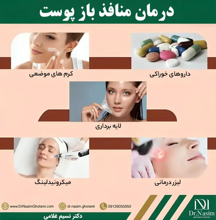راههای بستن منافذ باز پوست صورت