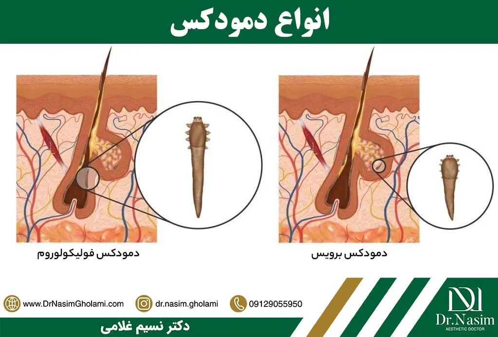 انواع دمودکس