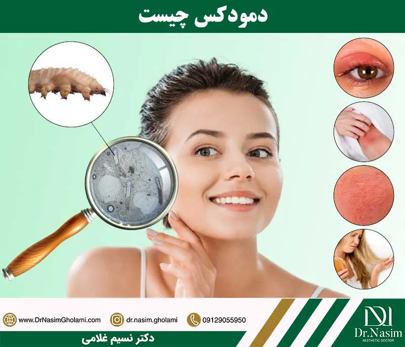 دمودکس چیست