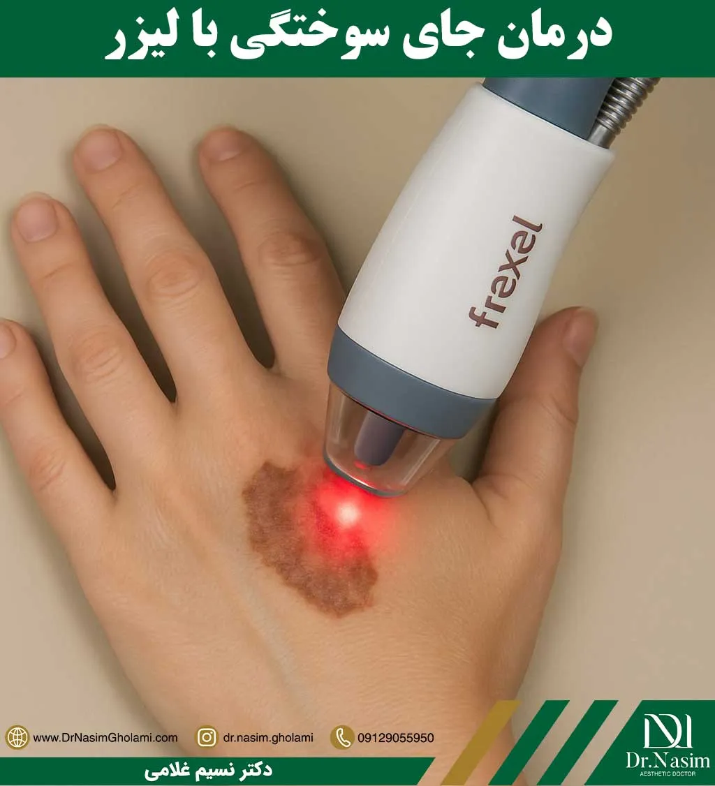 درمان جای سوختگی با لیزر