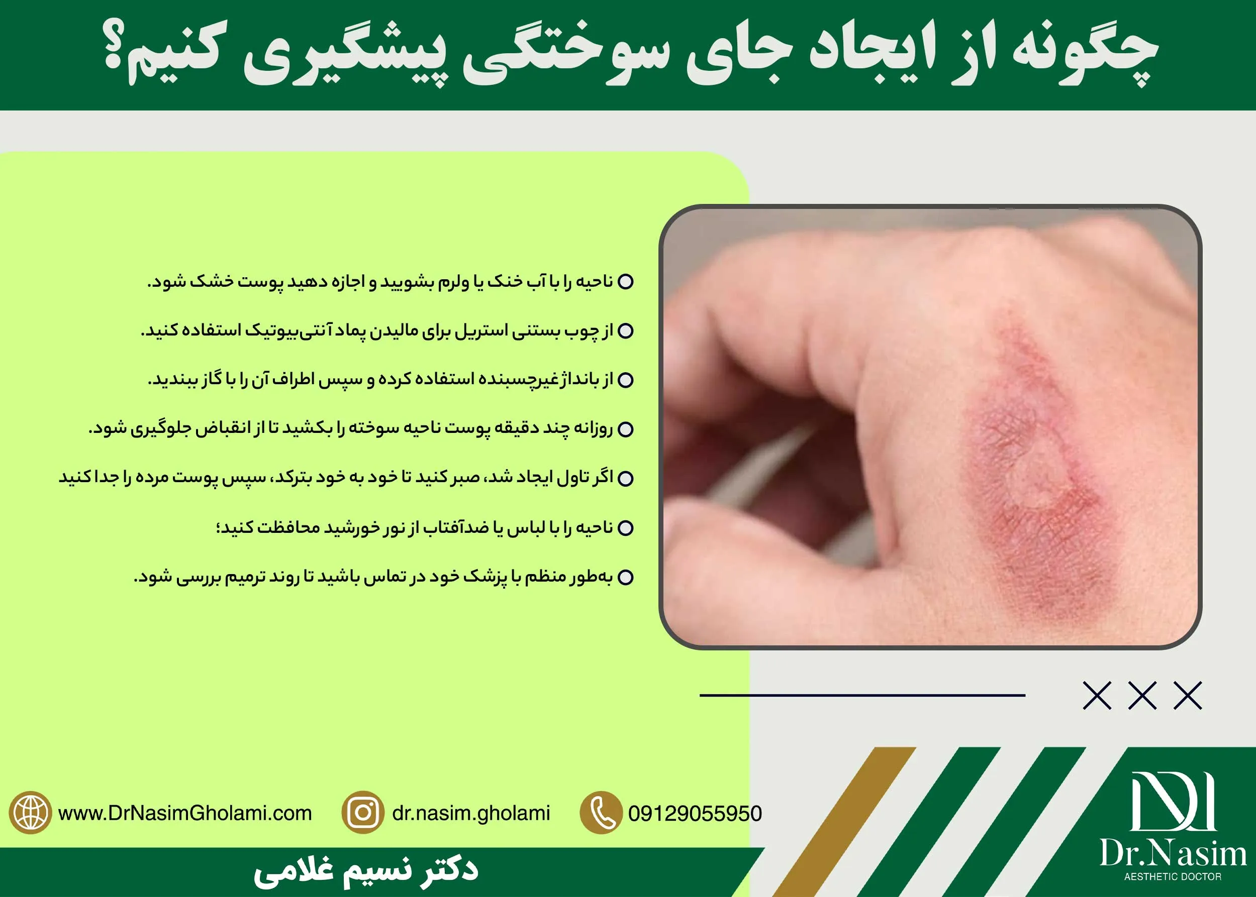 چیکار کنیم جای سوختگی نماند