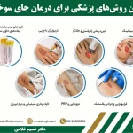 راههای رفع جای سوختگی