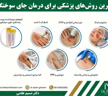 راههای رفع جای سوختگی