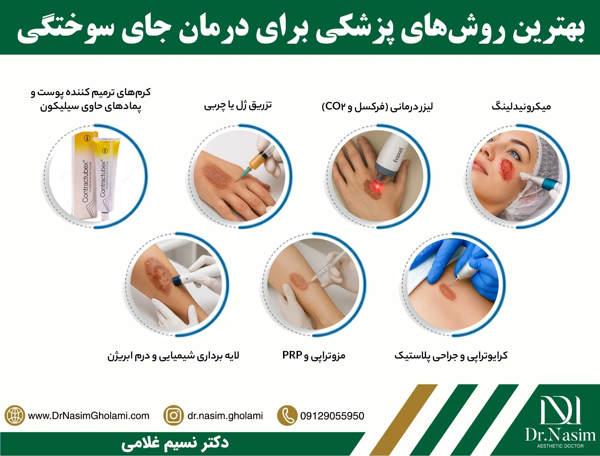 راههای رفع جای سوختگی