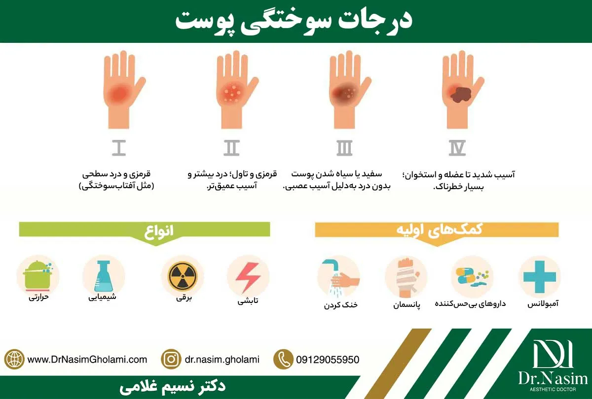 انواع درجات سوختگی