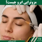 مزو ابرو چیست