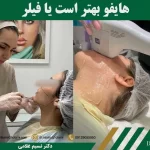 هایفو بهتر است یا فیلر