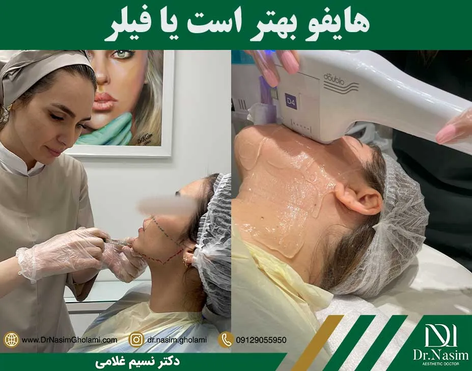 هایفو بهتر است یا فیلر