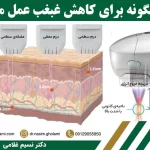 نحوه عملکرد هایفو غبغب