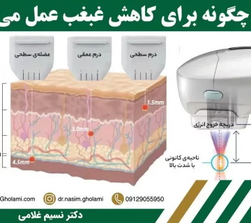 نحوه عملکرد هایفو غبغب