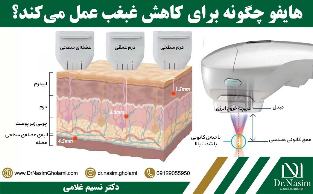 نحوه عملکرد هایفو غبغب