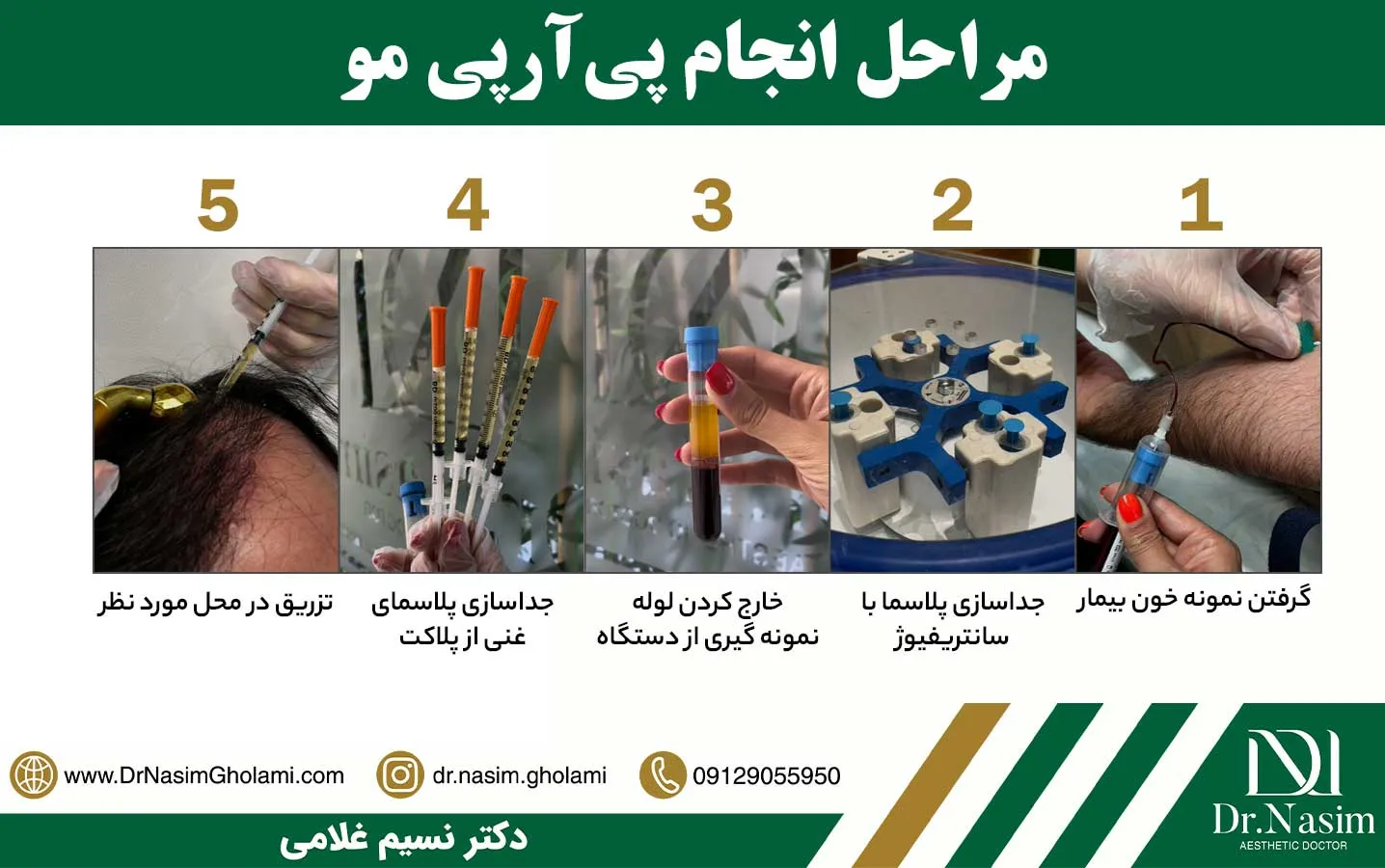 نحوه انجام پی آر پی مو