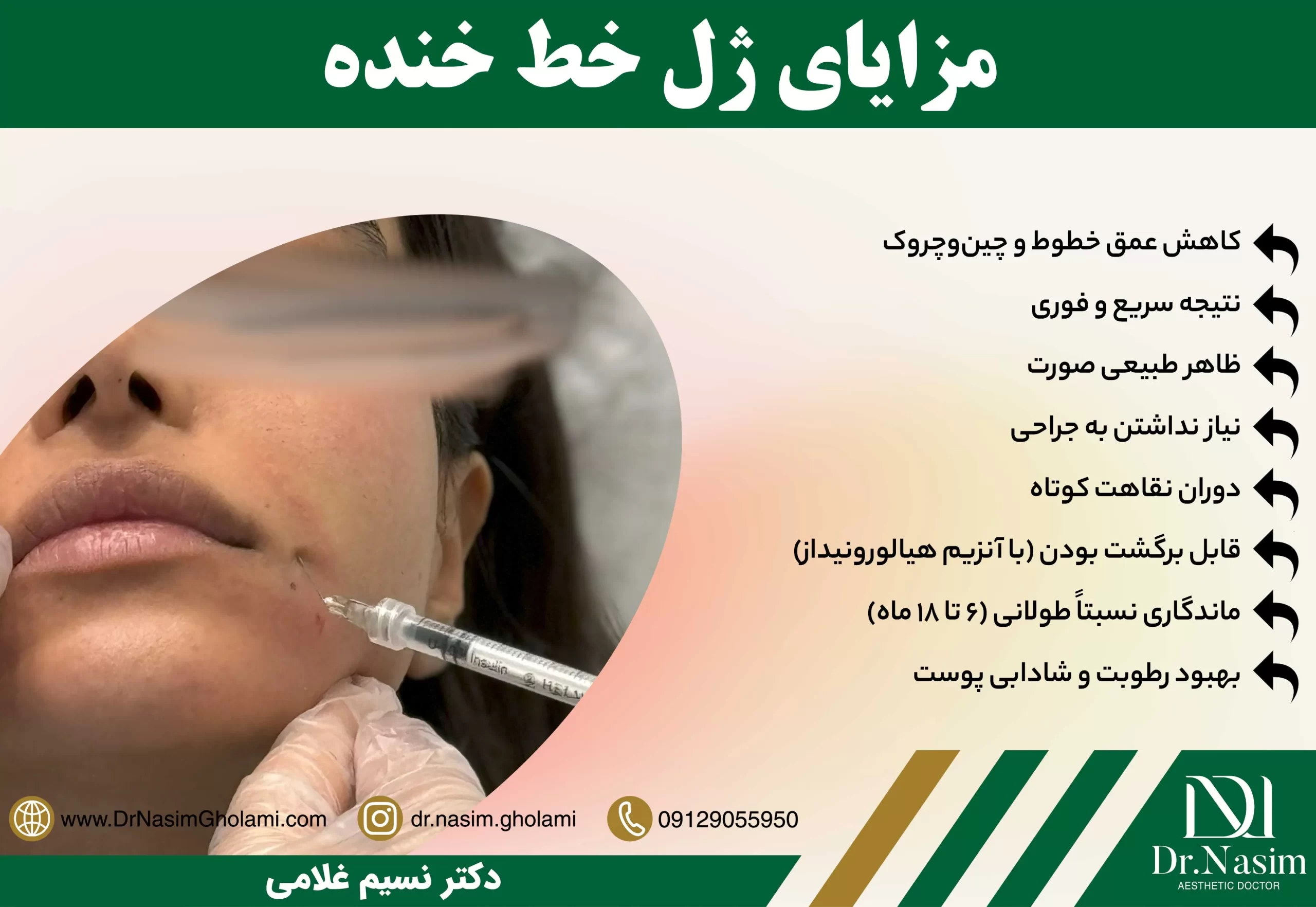 مزایای تزریق ژل برای رفع خط خنده