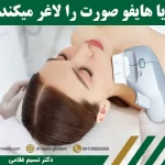 آیا هایفو صورت را لاغر می کند