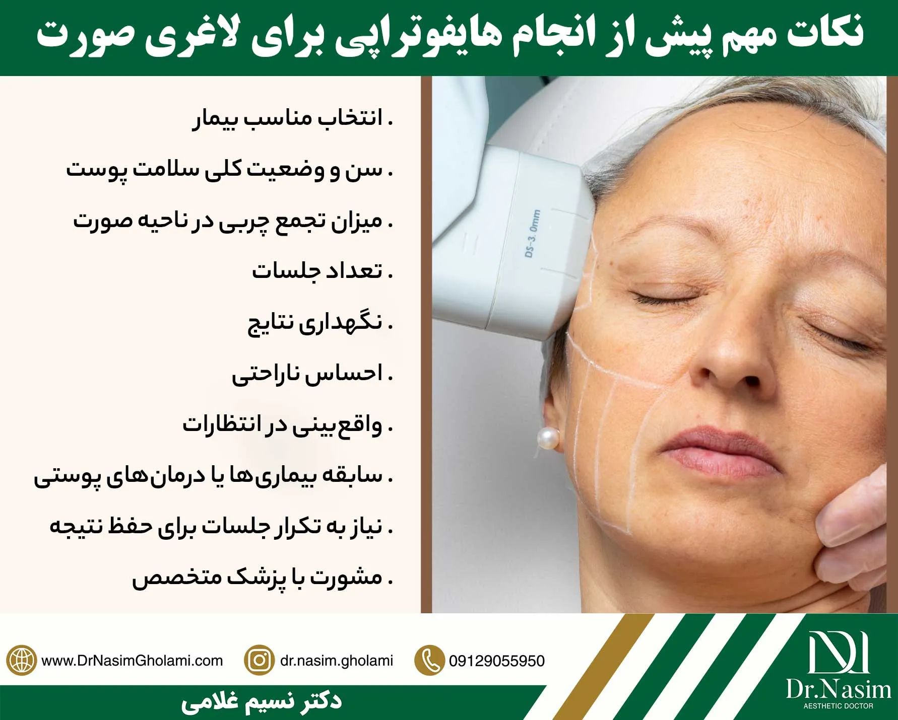 نکات مهم پیش از انجام هایفو برای لاغر کردن صورت