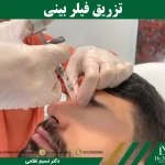 فیلر بینی چیست