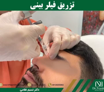 فیلر بینی چیست