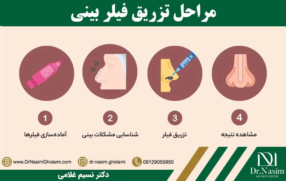 نحوه انجام تزریق فیلر به بینی