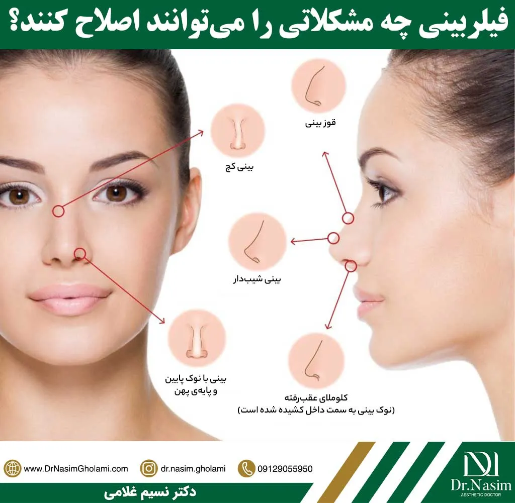 کاربردهای فیلر بینی