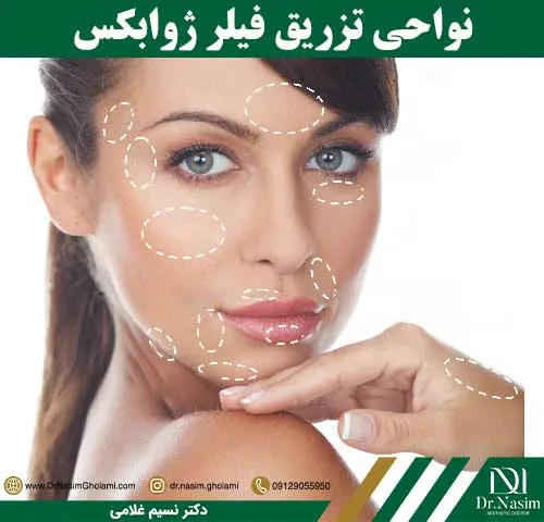 کاربردهای ژل ژوابکس