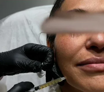 پی آر پی صورت چیست