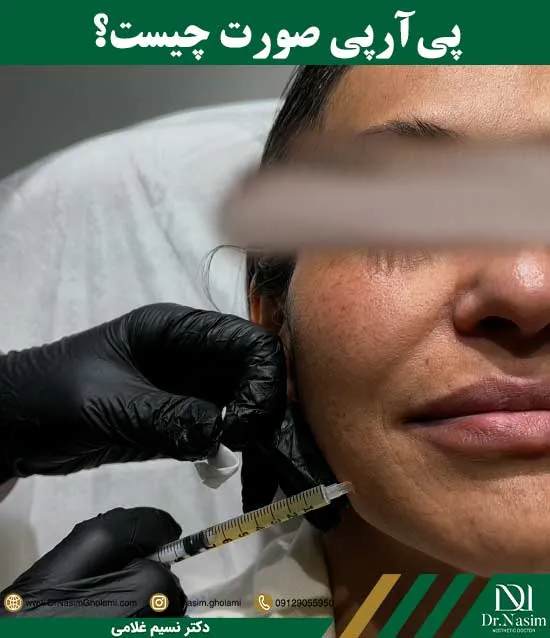 پی آر پی صورت چیست