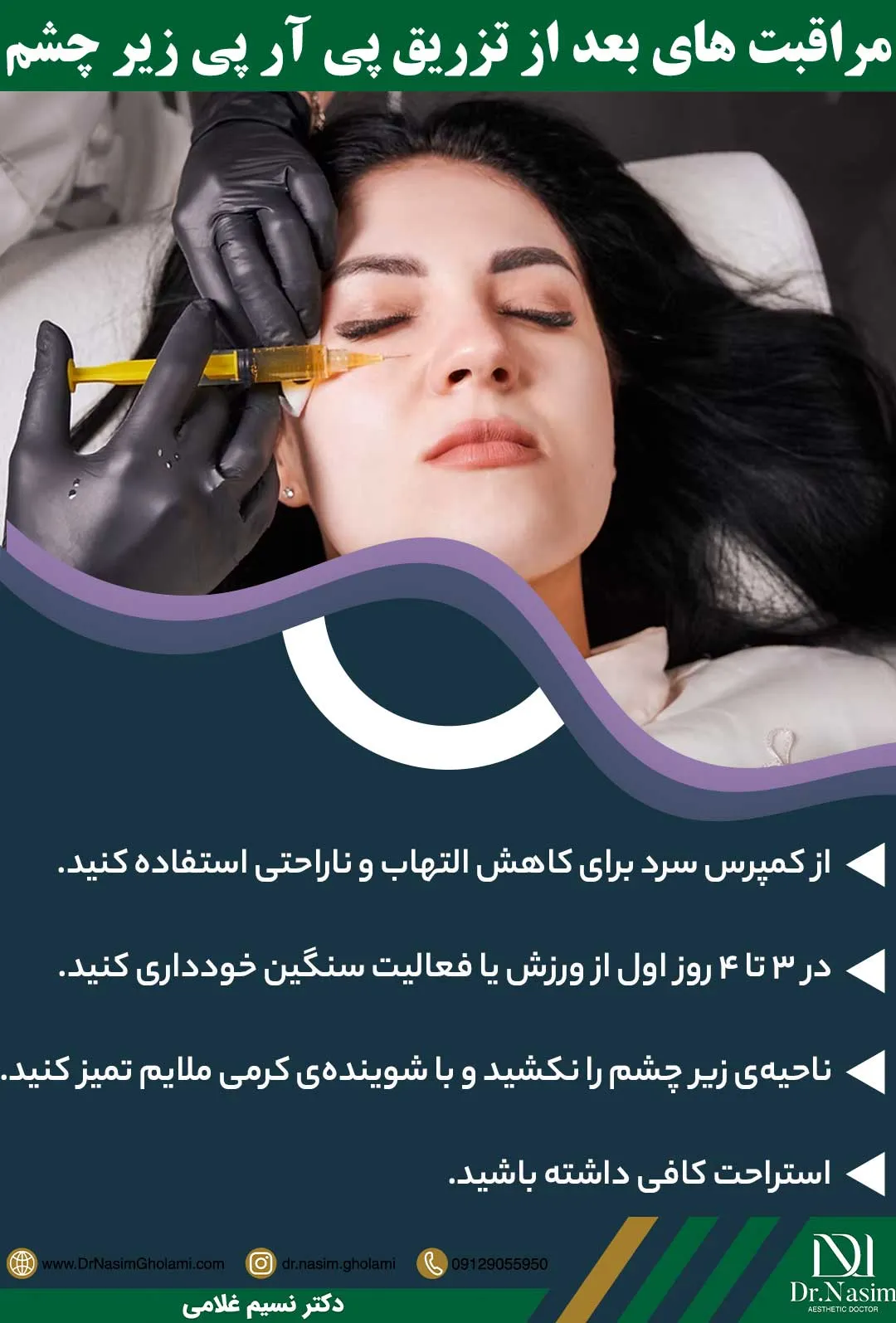 مراقبت های لازم بعد از تزریق پی آر پی به زیر چشم