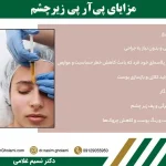 مزایای prp چشم