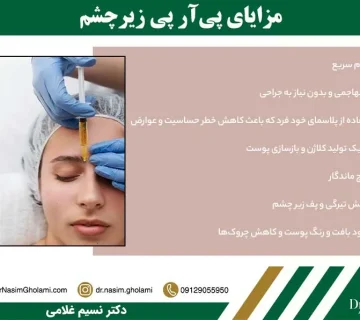 مزایای prp چشم